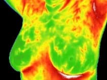 Thermography Screening